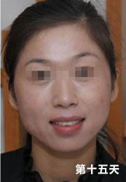 ���ݷ���Ƥ����ҽԺ