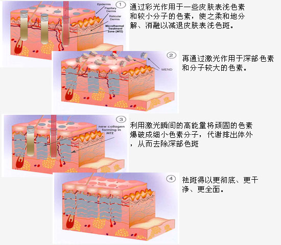 广州肤康皮肤病医院