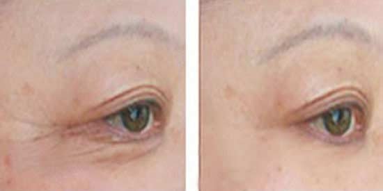 ���ݷ���Ƥ����ҽԺ