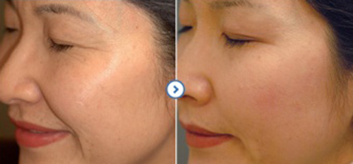 ���ݷ���Ƥ����ҽԺ